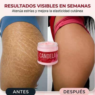 ZONA 1: MUSLOS FIRMES