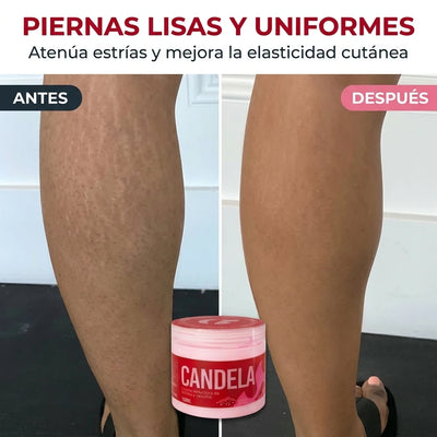 ZONA 3: Piernas Perfectas